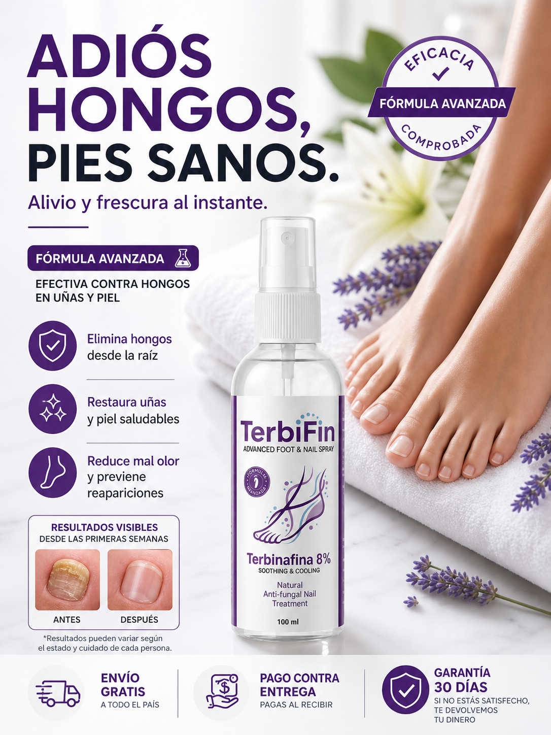 Terbifin